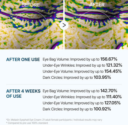 Dr. Melaxin Eyebag Cream - Best Dark Circle & Under Eye Bag Remover | UAE